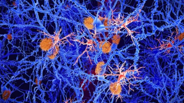 Комп'ютерний знімок клітин мозку
