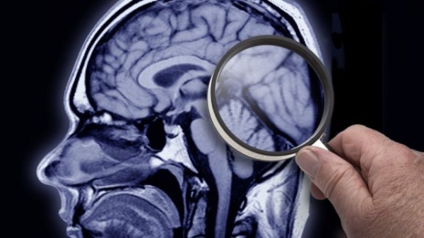 Вивчення МРТ-знімка мозку через лупу