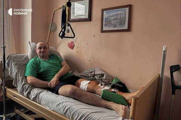 Поліцейський офіцер громади Олександр Шпак, який отримав поранення під час перестрілки в селі Нехворощ на Корсунщині / © Суспільне