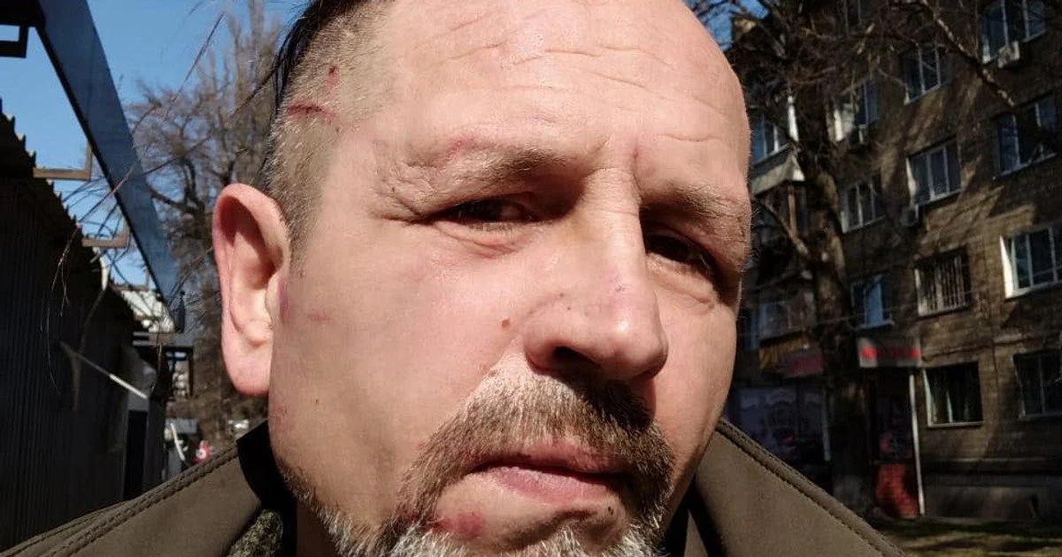 Володимир Балух заявив про побиття у столичному ТЦК Володимир Балух заявив про побиття у столичному ТЦК